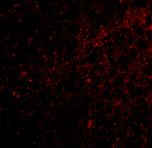 SAPAP3 Antibody in Immunohistochemistry (IHC)