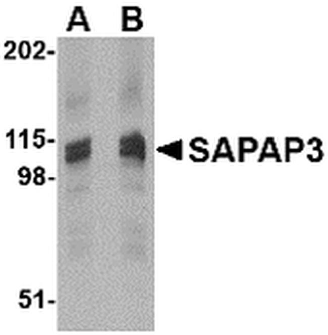 SAPAP3 Antibody in Western Blot (WB)