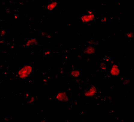 SLITRK5 Antibody in Immunocytochemistry (ICC/IF)