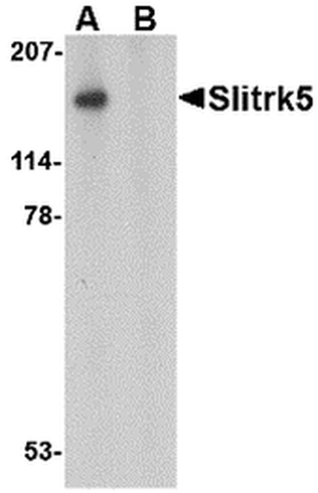 SLITRK5 Antibody in Western Blot (WB)