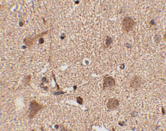 SLITRK5 Antibody in Immunohistochemistry (IHC)