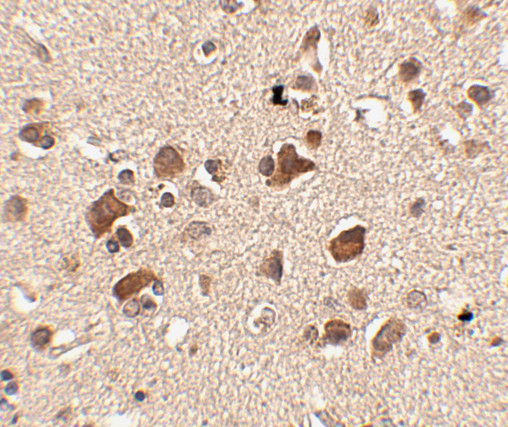 SLITRK6 Antibody in Immunohistochemistry (IHC)