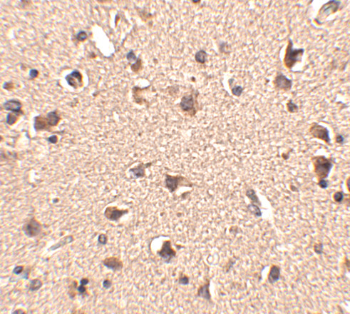 SLITRK6 Antibody in Immunohistochemistry (IHC)