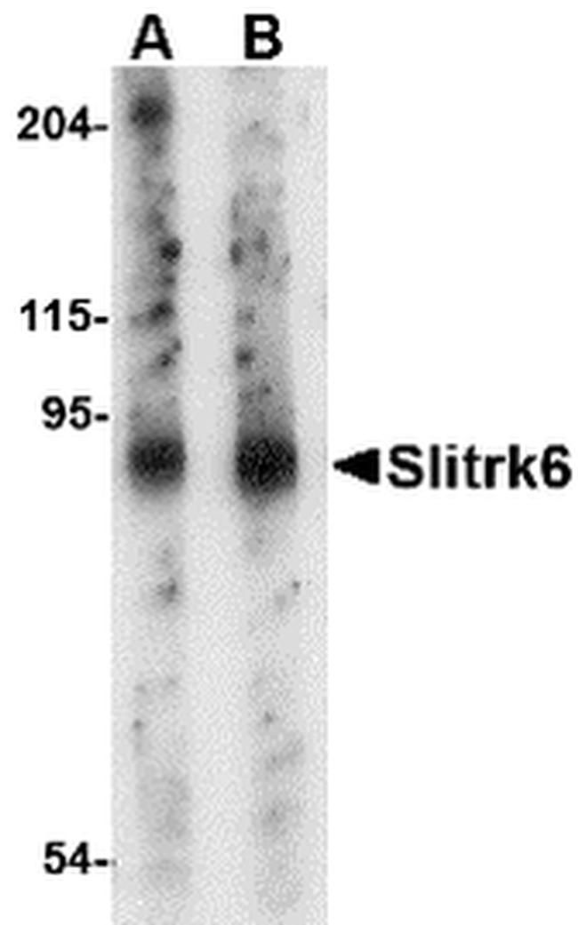 SLITRK6 Antibody in Western Blot (WB)