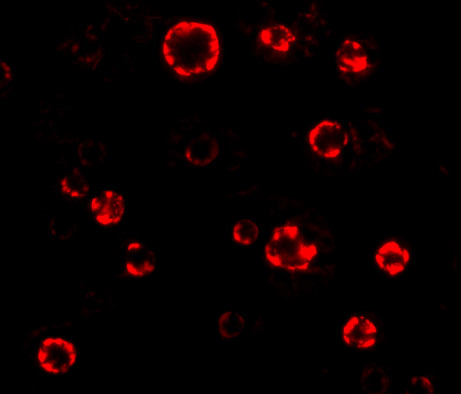 ATG16L1 Antibody in Immunocytochemistry (ICC/IF)