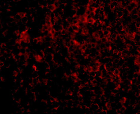 ATG5 Antibody in Immunocytochemistry (ICC/IF)