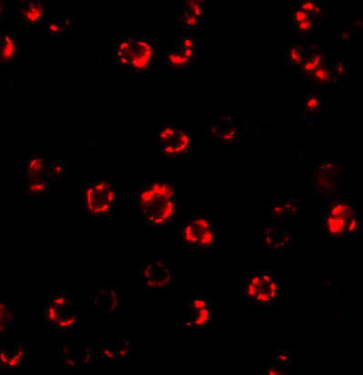 ATG16L1 Antibody in Immunocytochemistry (ICC/IF)