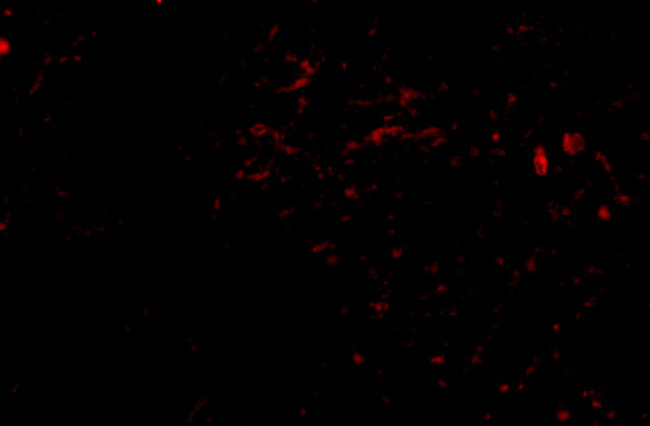 SIRT2 Antibody in Immunohistochemistry (IHC)