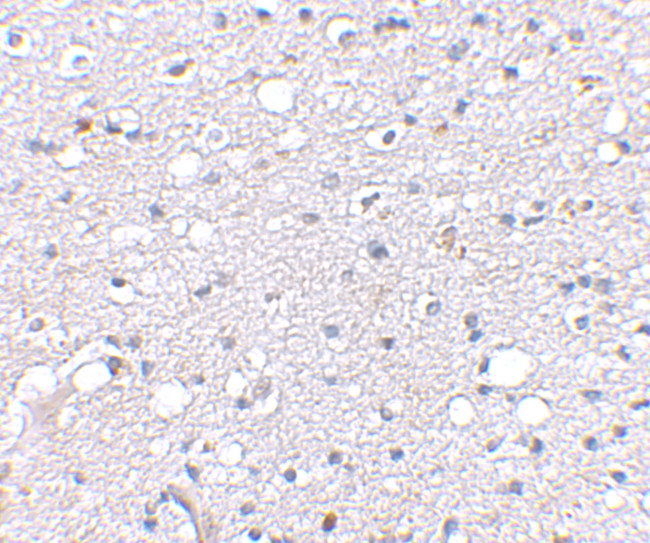 SIRT2 Antibody in Immunohistochemistry (IHC)