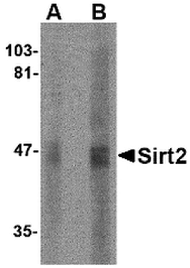 SIRT2 Antibody in Western Blot (WB)