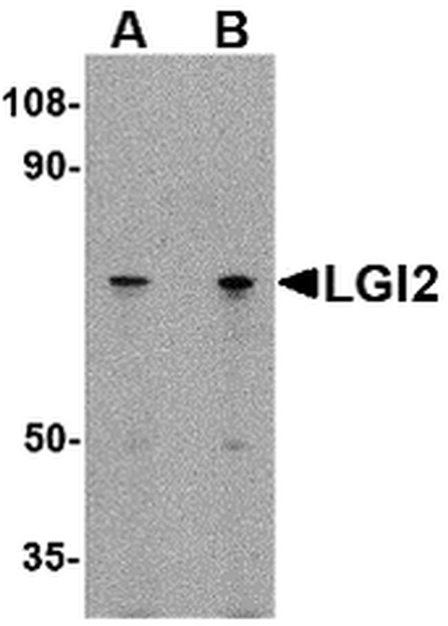 LGI2 Antibody in Western Blot (WB)