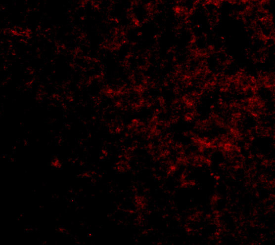 LGI2 Antibody in Immunocytochemistry (ICC/IF)