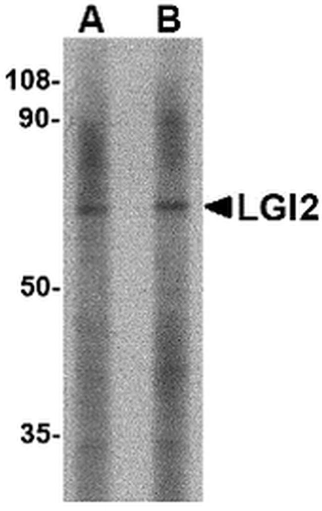 LGI2 Antibody in Western Blot (WB)