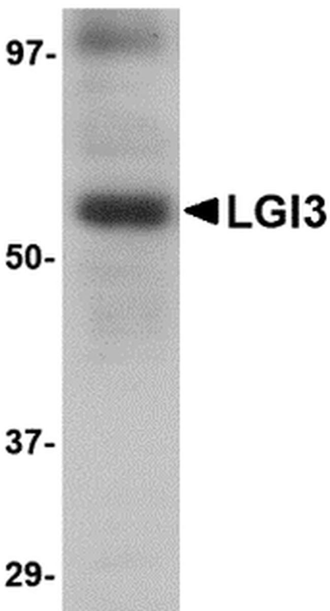 LGI3 Antibody in Western Blot (WB)