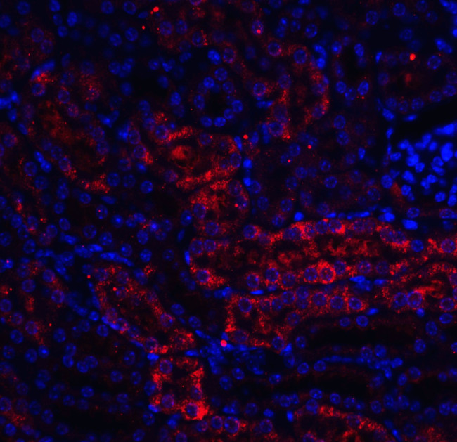 DDIT4 Antibody in Immunohistochemistry (IHC)