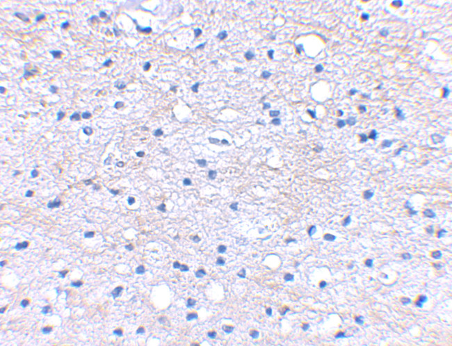 HAPLN2 Antibody in Immunohistochemistry (IHC)