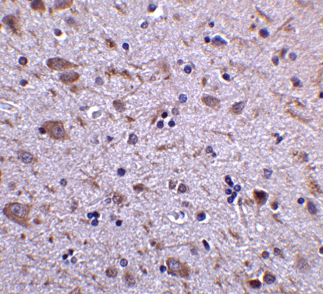 IRGM Antibody in Immunohistochemistry (IHC)