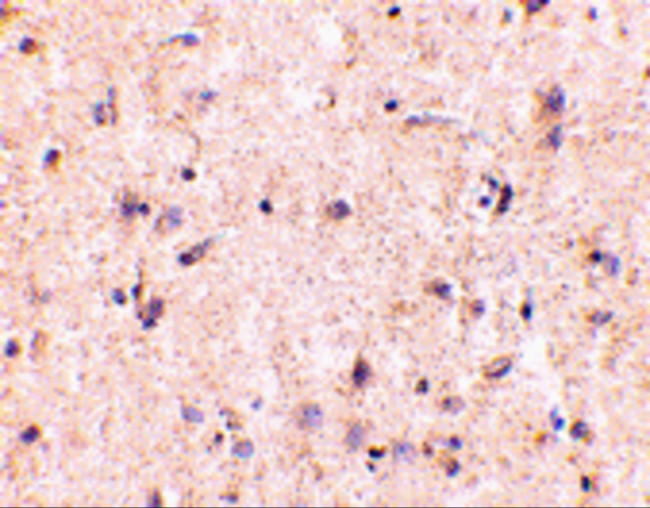 IRGM Antibody in Immunohistochemistry (IHC)