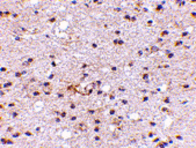 AMBRA1 Antibody in Immunohistochemistry (IHC)