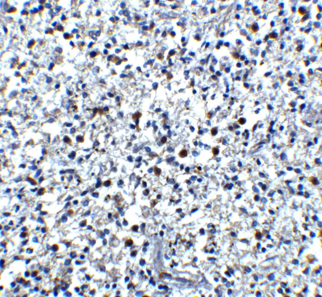 Cathelicidin Antibody in Immunohistochemistry (IHC)