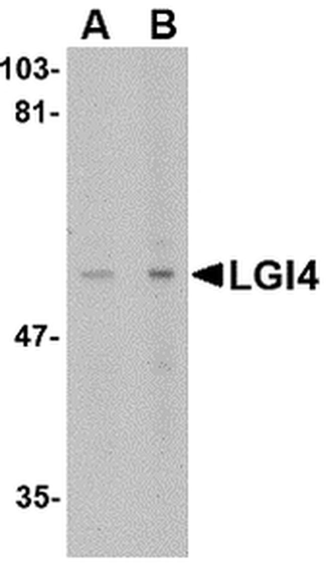 LGI4 Antibody in Western Blot (WB)