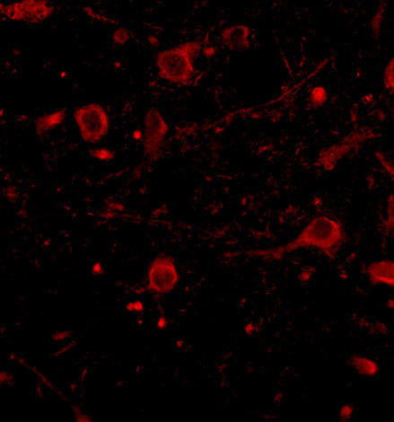 CAPS1 Antibody in Immunohistochemistry (IHC)