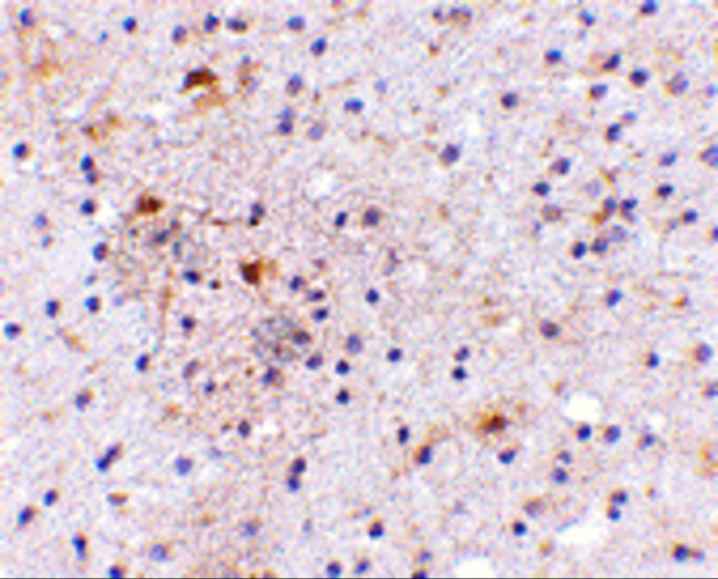 CAPS1 Antibody in Immunohistochemistry (IHC)