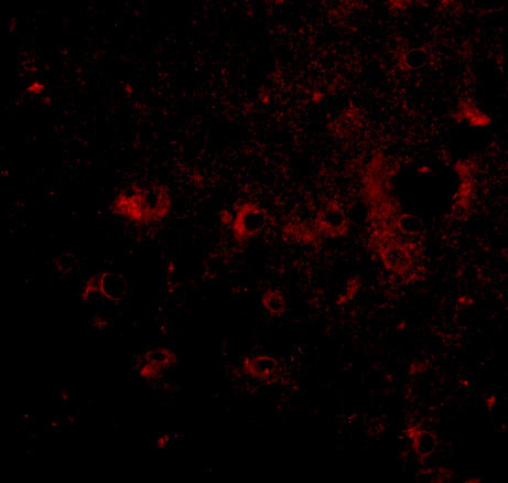 CADPS2 Antibody in Immunohistochemistry (IHC)