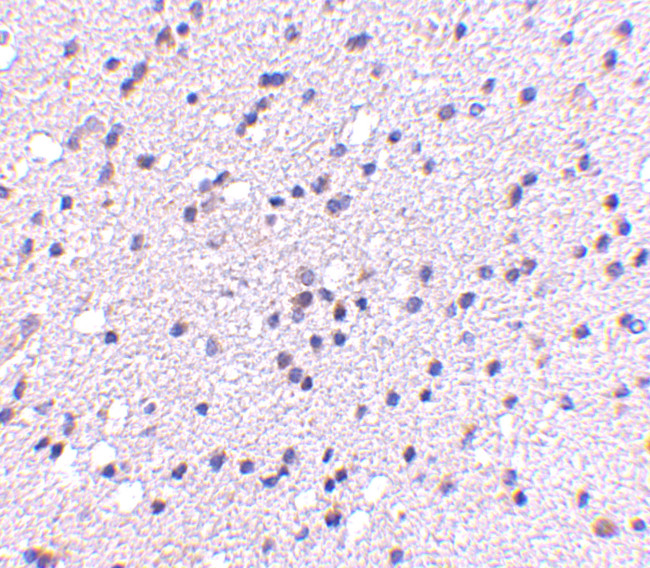 CADPS2 Antibody in Immunohistochemistry (IHC)