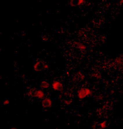 ELOVL6 Antibody in Immunohistochemistry (IHC)