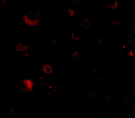 RIM2 Antibody in Immunohistochemistry (IHC)