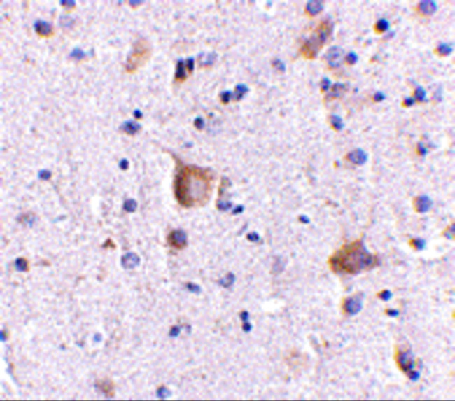 RIM2 Antibody in Immunohistochemistry (IHC)