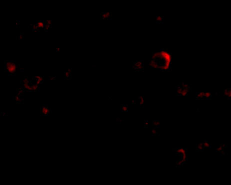 EVER2 Antibody in Immunocytochemistry (ICC/IF)