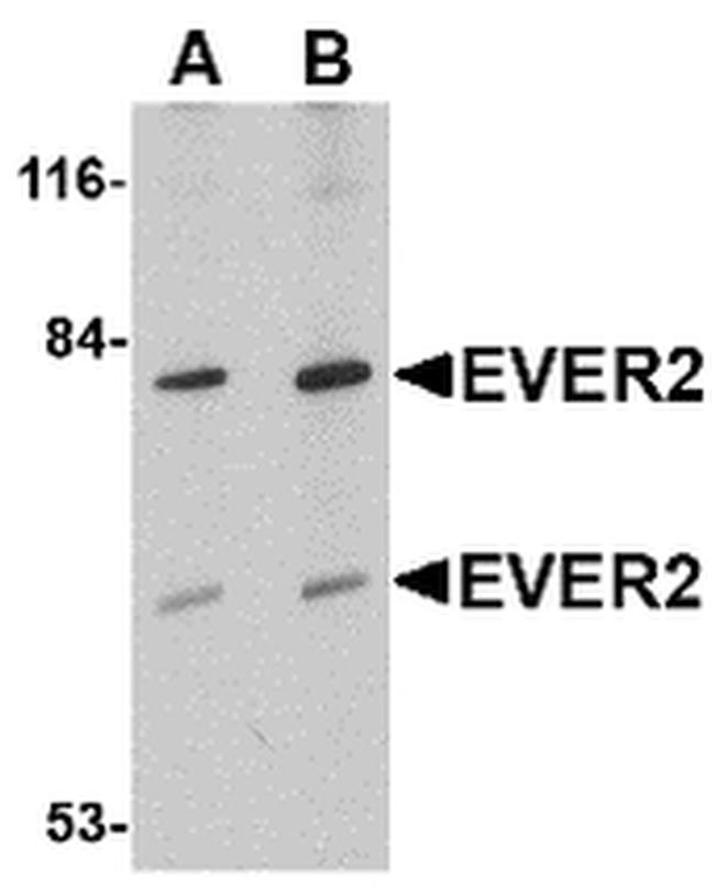 EVER2 Antibody in Western Blot (WB)