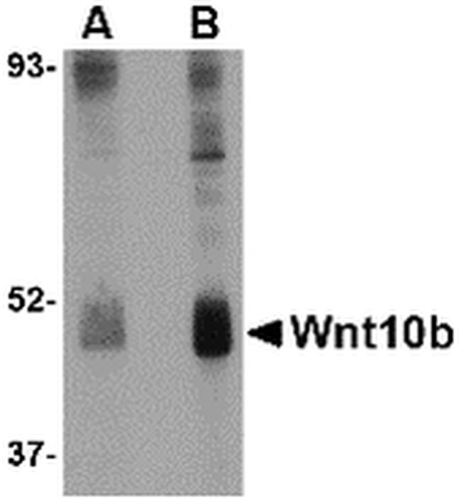 WNT10B Antibody in Western Blot (WB)