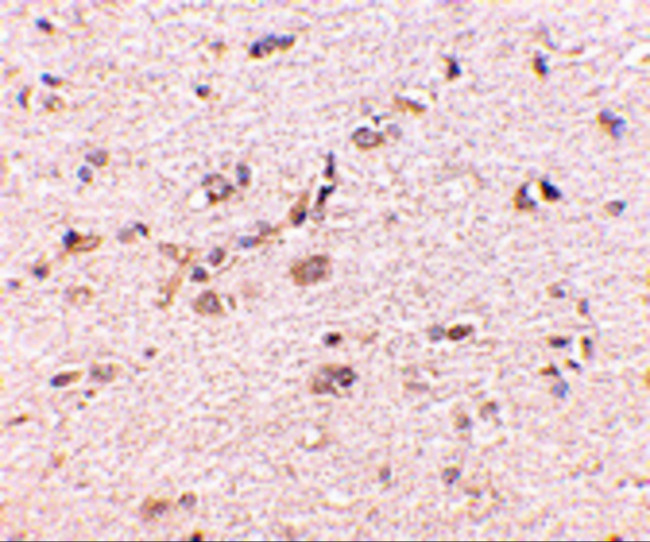 SAPAP1 Antibody in Immunohistochemistry (IHC)