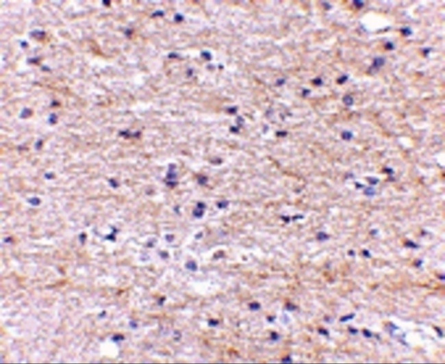 SATB2 Antibody in Immunohistochemistry (IHC)