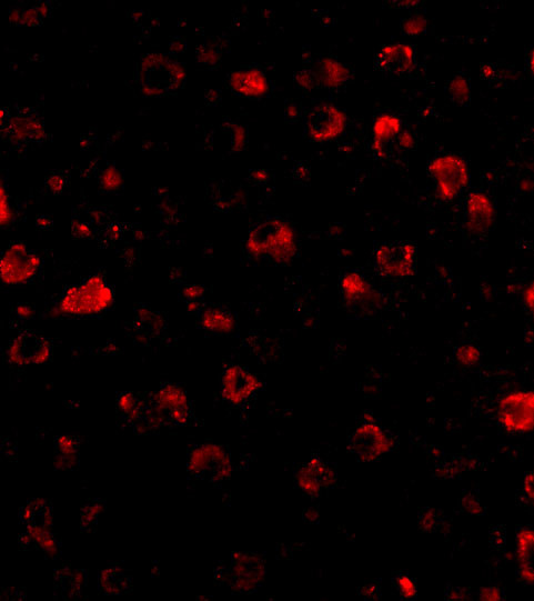 SATB1 Antibody in Immunocytochemistry (ICC/IF)