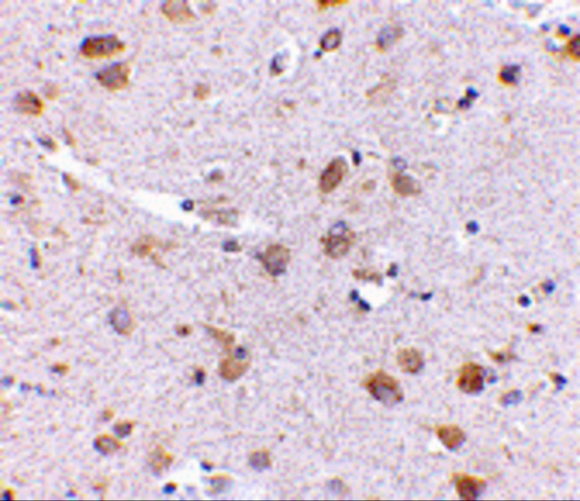 SATB1 Antibody in Immunohistochemistry (IHC)