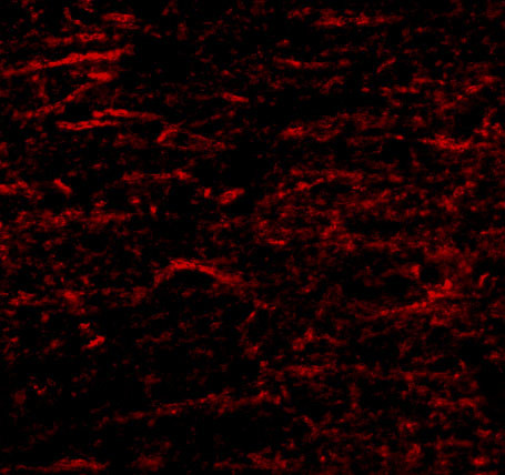 SATB1 Antibody in Immunocytochemistry (ICC/IF)