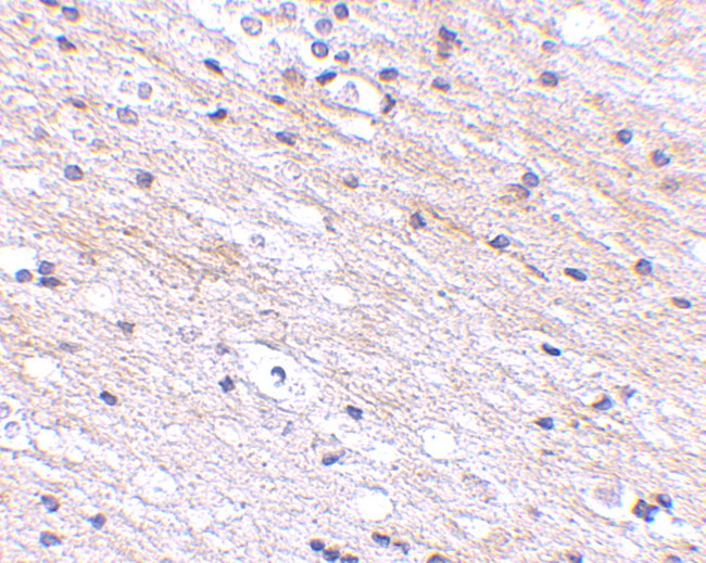 SATB1 Antibody in Immunohistochemistry (IHC)