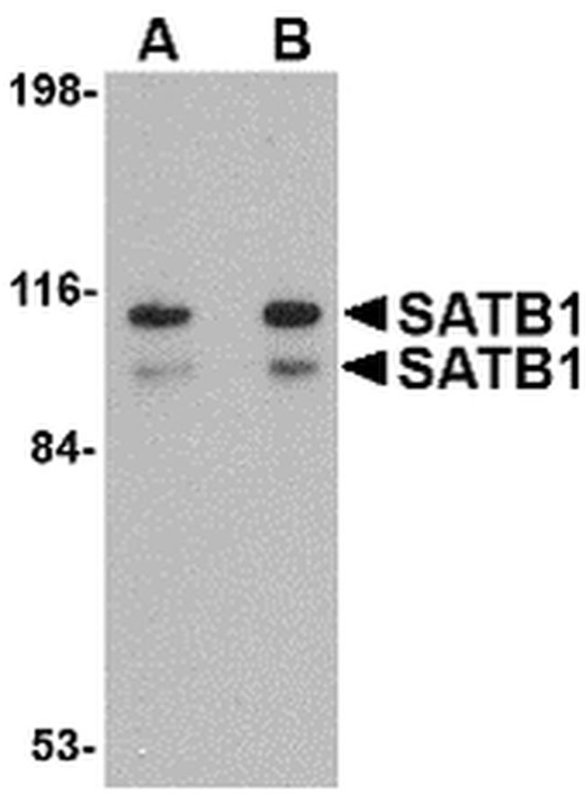 SATB1 Antibody in Western Blot (WB)