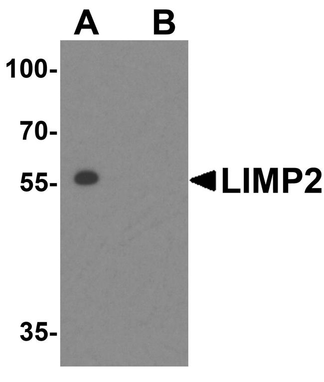 LIMP2 Antibody in Western Blot (WB)