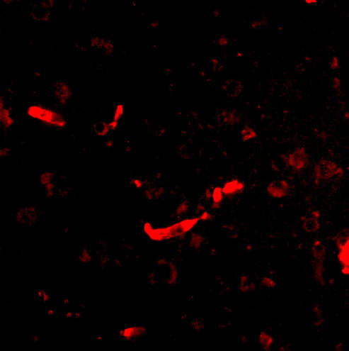 SAPAP2 Antibody in Immunocytochemistry (ICC/IF)