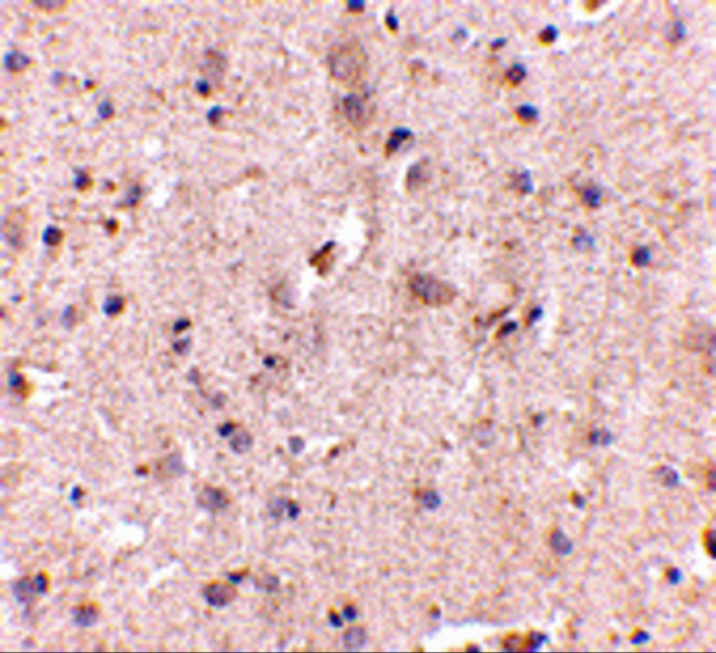 SAPAP2 Antibody in Immunohistochemistry (IHC)