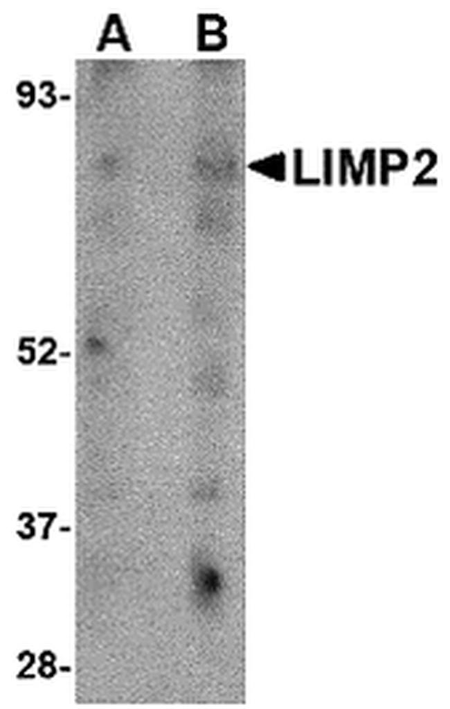 LIMP2 Antibody in Western Blot (WB)