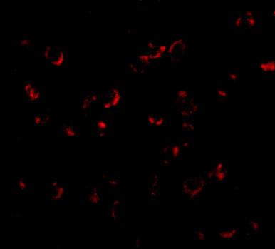 BICD1 Antibody in Immunocytochemistry (ICC/IF)