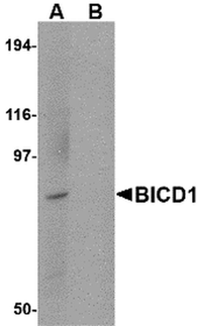 BICD1 Antibody in Western Blot (WB)