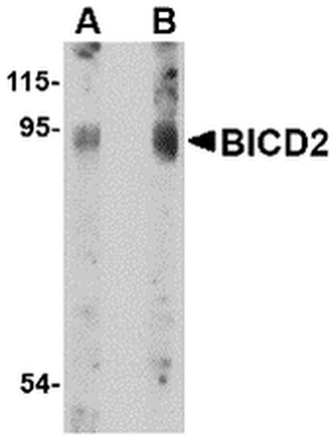 BICD2 Antibody in Western Blot (WB)