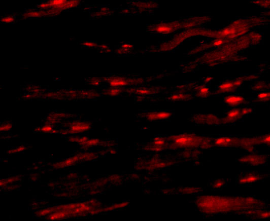 ASAH1 Antibody in Immunocytochemistry (ICC/IF)